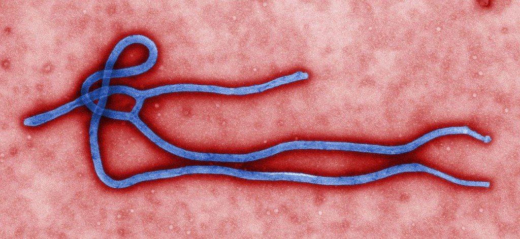 Kartic Chandran Discovers A A Possible Cure For All Five Known Ebola Viruses 