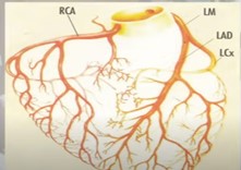 Know How To Reverse Heart Disease