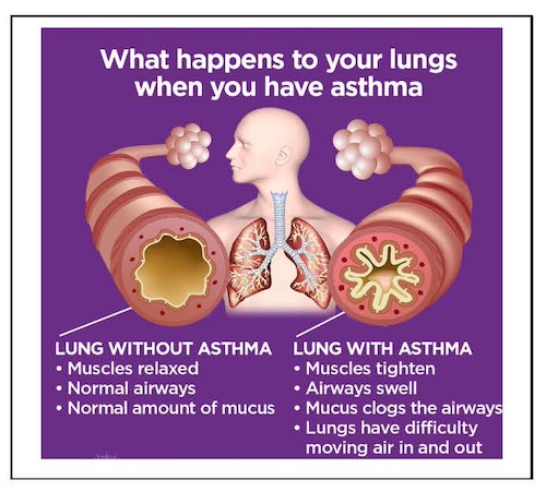 Poem: Asthma Awareness