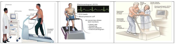 Go For Exercise Stress Test To Know Your Heart Conditions