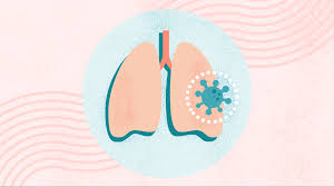 Know How Integrative Medicine Is Transforming Pneumonia Recovery: Healing Beyond Antibiotics